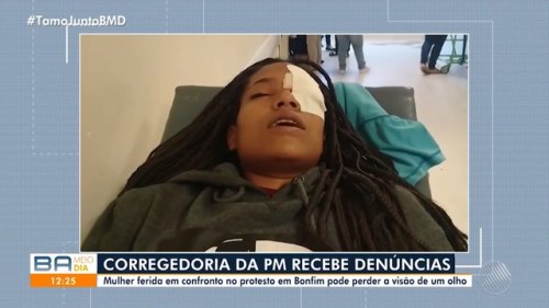 Jovem atingida no olho por bala de borracha, confronto entre PMs e espadeiros pode perder visão